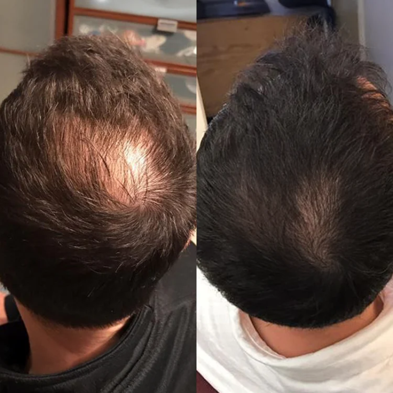 Foto de Federico Fernandez 