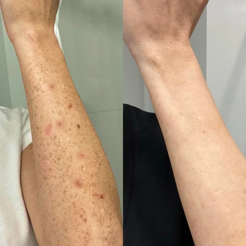 Foto de Piel sensible en brazos